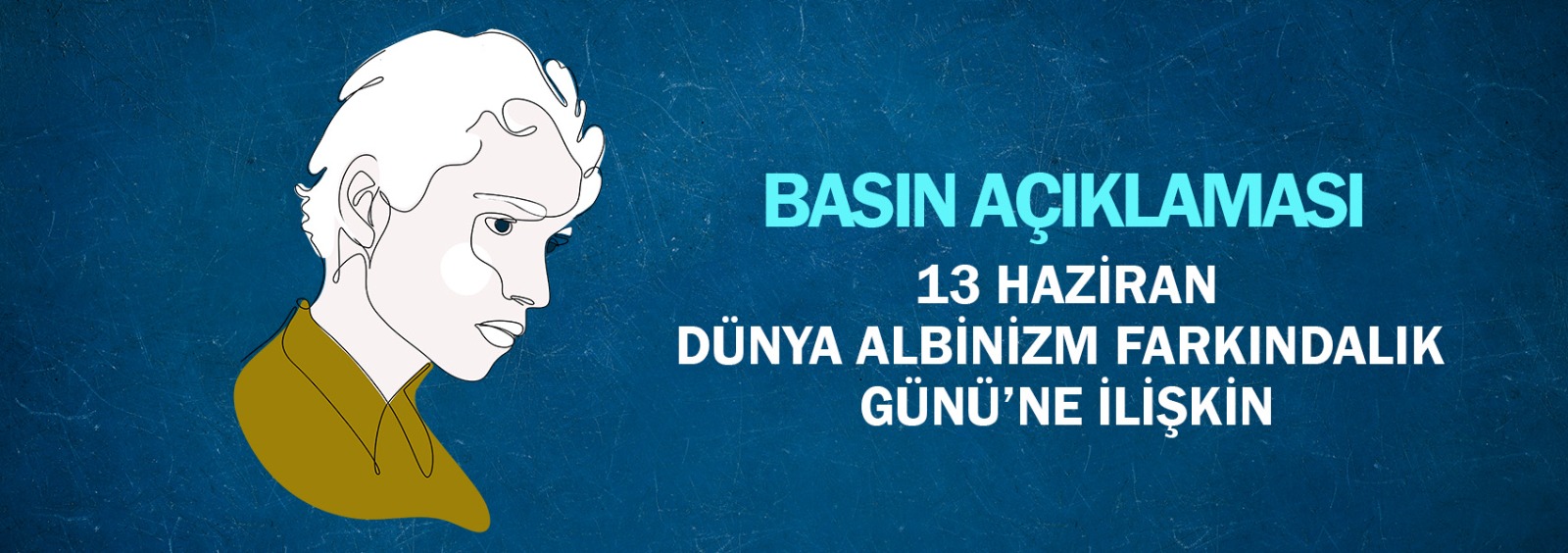 Dünya Albinizm Farkındalık Günü’ne İlişkin Basın Açıklaması