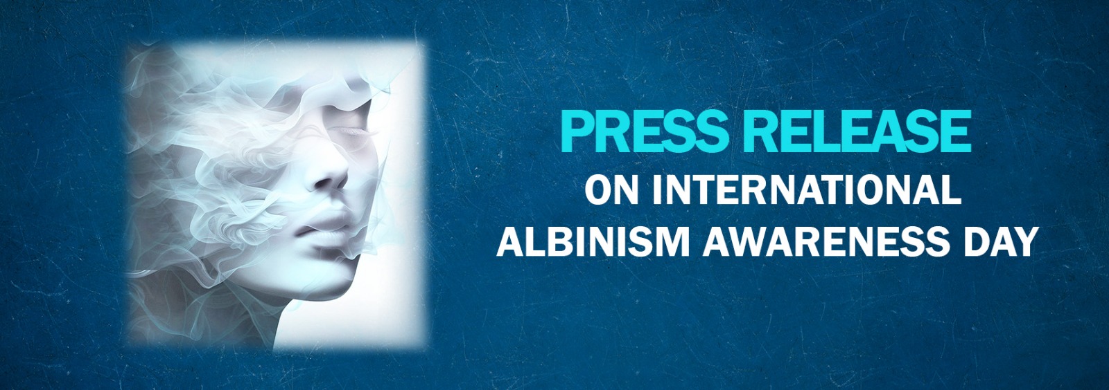 Press Release On International Albinism Awareness Day